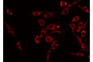 ABIN6274132 staining COLO205 by IF/ICC. (TNFSF15 Antikörper  (C-Term))