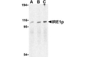 Image no. 1 for anti-Endoplasmic Reticulum To Nucleus Signaling 1 (ERN1) (C-Term) antibody (ABIN318702) (ERN1 Antikörper  (C-Term))