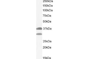 Western Blotting (WB) image for anti-E3 Ubiquitin-Protein Ligase SIAH1 (SIAH1) (N-Term) antibody (ABIN184675)