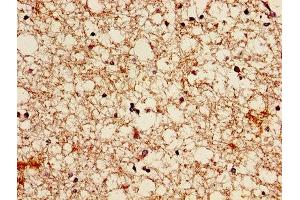 Immunohistochemistry of paraffin-embedded human brain tissue using ABIN7145700 at dilution of 1:100 (BMP7 Antikörper  (AA 293-431))