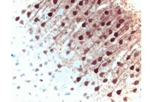 Immunohistochemical staining of ERK1 in pyrimidal cells from the rat cortex: formalin-fixed paraffin-embedded tissue, with citrate pre-treatment (40X magnification). (ERK1 Antikörper  (AA 325-345))