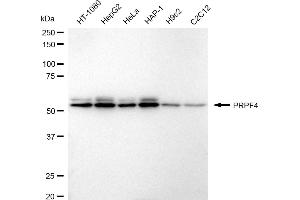 Western blotting analysis using PRPF4 antibody (ABIN7800056). (Rekombinanter PRPF4 Antikörper)