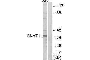 Western blot analysis of extracts from COLO cells, using GNAT1 antibody. (GNAT1 Antikörper  (Internal Region))