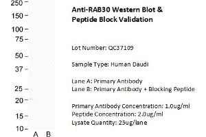 Host: Rabbit Target Name: RAB30 Sample Type: Human Daudi Lane A: Primary Antibody  Lane B: Primary Antibody + Blocking Peptide  Primary Antibody Concentration: 1. (RAB30 Antikörper  (C-Term))