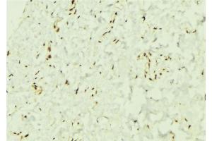 ABIN6276544 at 1/100 staining Mouse muscle tissue by IHC-P. (TCF4 Antikörper  (N-Term))