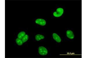 Immunofluorescence of purified MaxPab antibody to WBSCR22 on HeLa cell. (WBSCR22 Antikörper  (AA 1-281))