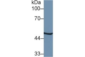 Detection of PSMC2 in Mouse Liver lysate using Polyclonal Antibody to Proteasome 26S Subunit, ATPase 2 (PSMC2) (PSMC2 Antikörper  (AA 1-433))