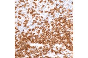 Immunohistochemistry (IHC) image for anti-CD3 epsilon (CD3E) (AA 157-207) antibody (ABIN7454035) (Rekombinanter CD3 epsilon Antikörper  (AA 157-207))