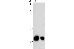 Western Blot analysis of Hela cell and Human liver cancer tissue using TXN Polyclonal Antibody at dilution of 1:700 (TXN Antikörper)