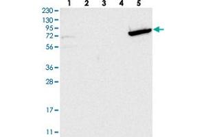 Western blot analysis of Lane 1: RT-4, Lane 2: U-251 MG, Lane 3: Human Plasma, Lane 4: Liver, Lane 5: Tonsil with GBP6 polyclonal antibody .