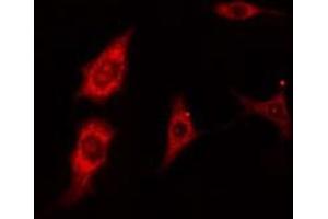 Immunofluorescence (fixed cells) (IF/ICC) image for anti-Myosin Regulatory Light Polypeptide 9 (MYL9) (N-Term) antibody (ABIN6266252)