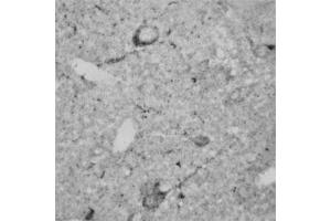 IHC on rat brain (paraffin sections) using Rabbit antibody to RhoA   at a concentration of 15 µg/ml, incubated overnight and developed with DAB Ni.