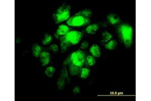 Image no. 2 for anti-Interferon Regulatory Factor 5 (IRF5) antibody (ABIN6745988) (IRF5 Antikörper)