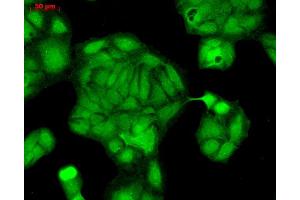Immunofluorescence (fixed cells) (IF/ICC) image for anti-RAB4A, Member RAS Oncogene Family (RAB4A) (C-Term) antibody (FITC) (ABIN2486640)
