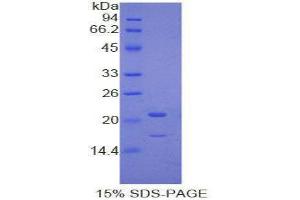SDS-PAGE (SDS) image for Proteinase 3 (PRTN3) (AA 71-247) protein (His tag) (ABIN2121967)