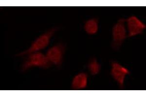ABIN6269342 staining HT29 by IF/ICC. (PRKAA1 Antikörper  (C-Term))
