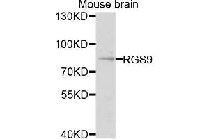 Western blot analysis of extracts of mouse brain cells, using RGS9 antibody.