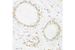 Immunohistochemistry of paraffin-embedded human breast using RBPJ Antibody (ABIN1876876) at dilution of 1:100 (40x lens). (RBPJ Antikörper)