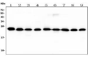 Western blot analysis of RAB11B using anti-RAB11B antibody (ABIN7602766).