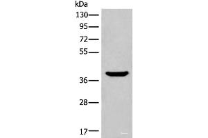 Western blot analysis of Mouse liver tissue lysate using ADORA3 Polyclonal Antibody at dilution of 1:400 (Adenosine A3 Receptor Antikörper)