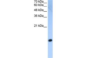 WB Suggested Anti-HIST2H2AC Antibody Titration:  2. (HIST2H2AC Antikörper  (Middle Region))