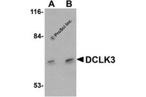 Western Blotting (WB) image for anti-Doublecortin-Like Kinase 3 (DCLK3) (N-Term) antibody (ABIN1031346) (DCLK3 Antikörper  (N-Term))