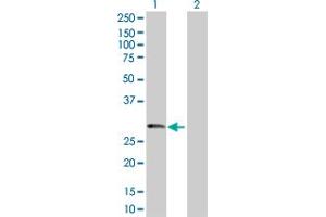 Western Blot analysis of PRSS1 expression in transfected 293T cell line by PRSS1 MaxPab polyclonal antibody. (PRSS1 Antikörper  (AA 1-247))