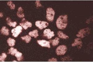 Immunofluorescent staining of A431 cells. (ARNT Antikörper  (AA 461-574))
