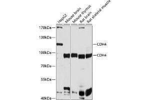 Western blot analysis of extracts of various cell lines, using CDH4 antibody (ABIN6129232, ABIN6138295, ABIN6138296 and ABIN6214850) at 1:1000 dilution. (Cadherin 4 Antikörper  (AA 757-916))