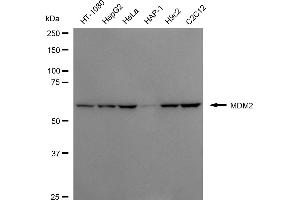 Western blotting analysis using MDM2 antibody (ABIN7799345).