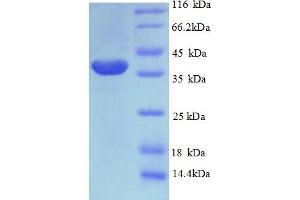 SDS-PAGE (SDS) image for PHD Finger Protein 5A (PHF5A) (AA 1-110), (full length) protein (GST tag) (ABIN5710091)