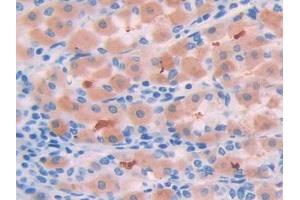 Immunohistochemistry (IHC) image for anti-serpin Peptidase Inhibitor, Clade A (Alpha-1 Antiproteinase, Antitrypsin), Member 6 (SERPINA6) (AA 25-195) antibody (ABIN1174369)