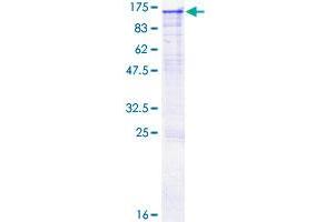 OSBPL8 Protein (AA 1-847) (GST tag)