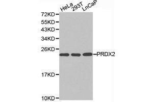 Western Blotting (WB) image for anti-Peroxiredoxin 2 (PRDX2) antibody (ABIN1874253) (Peroxiredoxin 2 Antikörper)