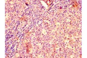 IHC image of ABIN7145433 diluted at 1:500 and staining in paraffin-embedded human tonsil tissue performed on a Leica BondTM system. (GRK2 Antikörper  (AA 2-221))