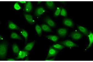 Immunofluorescence analysis of MCF7 cells using TEAD1 Polyclonal Antibody (TEAD1 Antikörper)