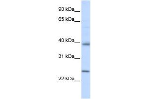 WB Suggested Anti-CLDN7 Antibody Titration: 0. (Claudin 7 Antikörper  (C-Term))