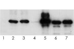 Western blot analysis of human tau (2N4R) using various antisera. (tau Antikörper  (Isoform 6, pTyr18))
