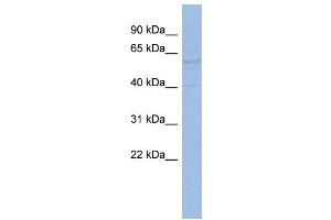 WB Suggested Anti-TRIM4 Antibody Titration:  0.