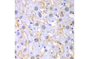 Immunohistochemistry of paraffin-embedded human liver injury using FAH antibody. (FAH Antikörper  (AA 1-419))