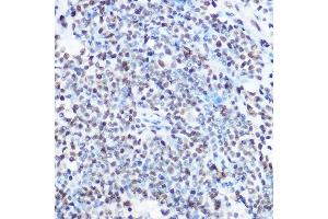 Immunohistochemistry (IHC) image for anti-Squamous Cell Carcinoma Antigen Recognized By T Cells 3 (SART3) (AA 664-963) antibody (ABIN6147392)