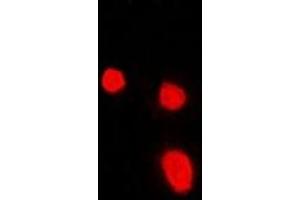 Immunofluorescent analysis of Malin staining in Hela cells. (NHLRC1 Antikörper)