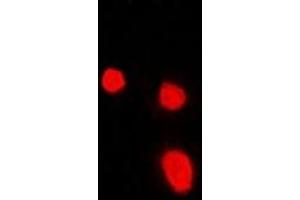 Immunofluorescent analysis of Malin staining in Hela cells.