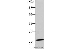 Western blot analysis of 293T cell, using DUT Polyclonal Antibody at dilution of 1:500 (Deoxyuridine Triphosphatase (DUT) Antikörper)