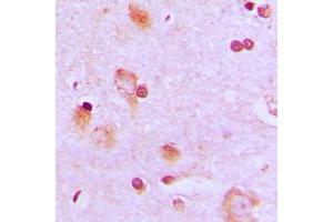 Immunohistochemical analysis of CEP57 staining in human brain formalin fixed paraffin embedded tissue section. (CEP57 Antikörper  (Center))