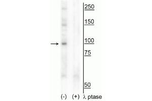 Western blot of human T47D cell lysate showing specific immunolabeling of the ~100 kDa CtIP phosphorylated at Thr847 in the first lane (-). (Retinoblastoma Binding Protein 8 Antikörper  (pThr847))