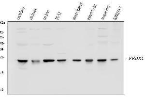 Western blot analysis of Peroxiredoxin 1 using anti-Peroxiredoxin 1 antibody (ABIN3043903).