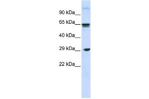 Western Blotting (WB) image for anti-C-Type Lectin Domain Family 4, Member M (CLEC4M) antibody (ABIN2458650) (C-Type Lectin Domain Family 4, Member M (CLEC4M) Antikörper)