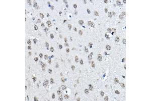 Immunohistochemistry of paraffin-embedded mouse brain using MonoMethyl-Histone H3-K27 Rabbit pAb (ABIN3023262, ABIN3023263, ABIN3023264, ABIN1513004 and ABIN6219518) at dilution of 1:100 (40x lens).