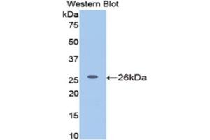 Western blot analysis of the recombinant protein. (MGEA5 Antikörper  (AA 19-222))